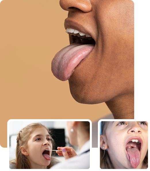 What is Tongue Examination