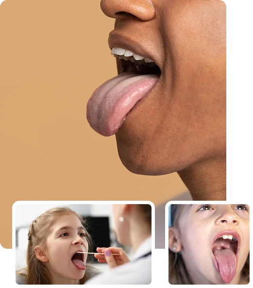 What is Tongue Examination