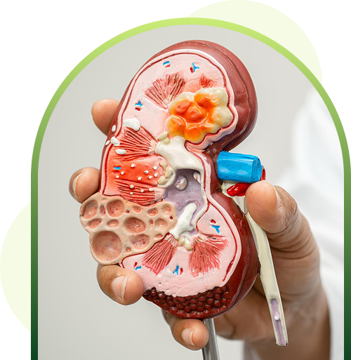 kidney disease