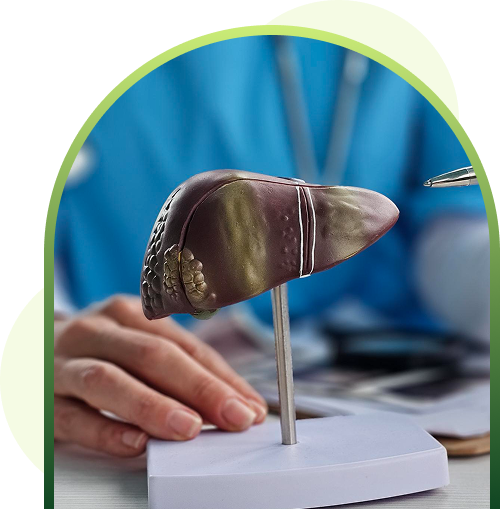 fatty liver