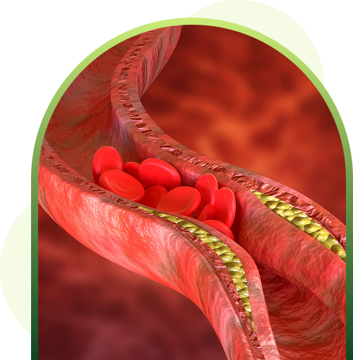 heart care