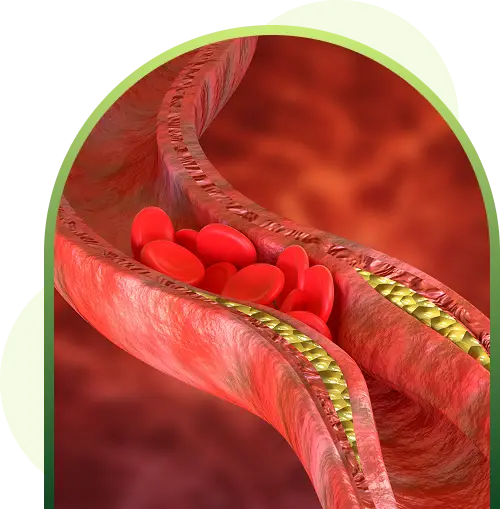 heart care