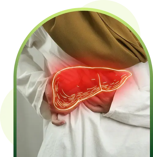Liver Cirrhosis