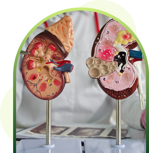 kidney disease