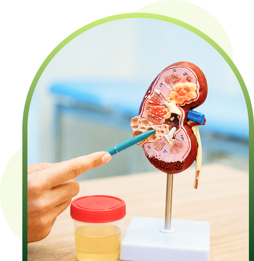 kidney disease