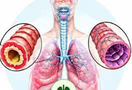 vamana condition reversed